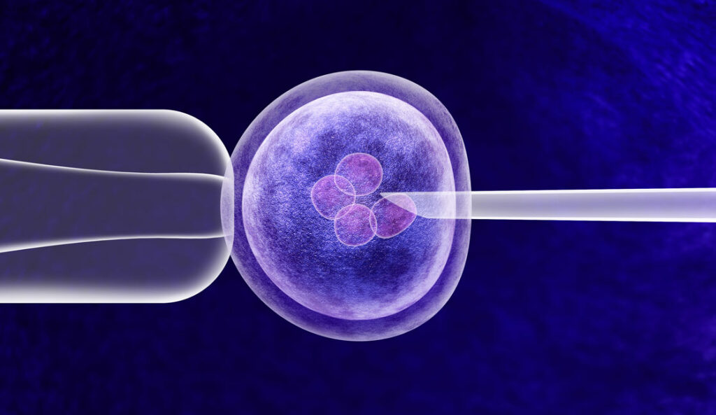 IVF Treatment