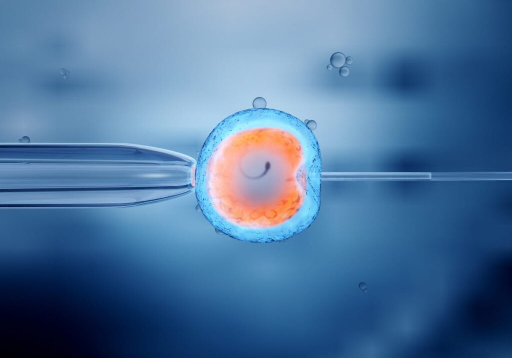 IVF Treatment